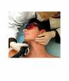 epilation laser homme